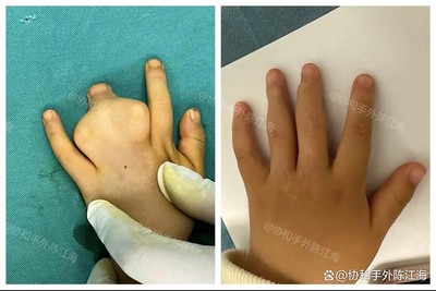 info-1080-721 info-1080-721